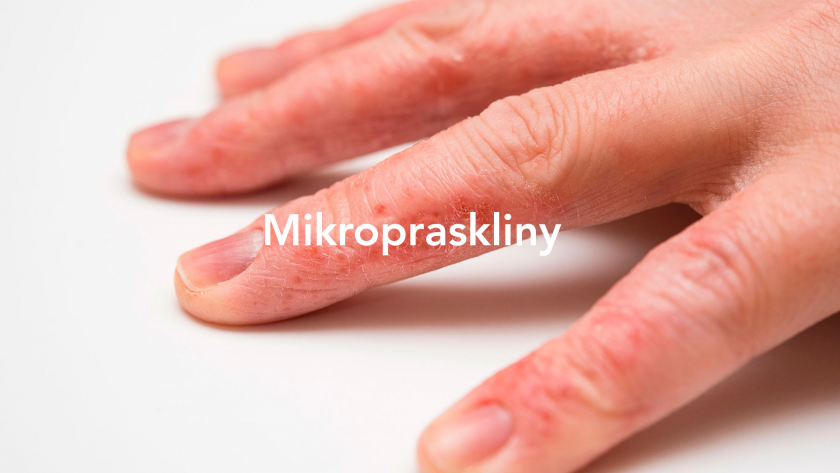 mikropraskliny