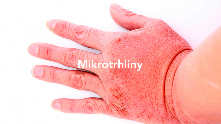 mikrotrhliny