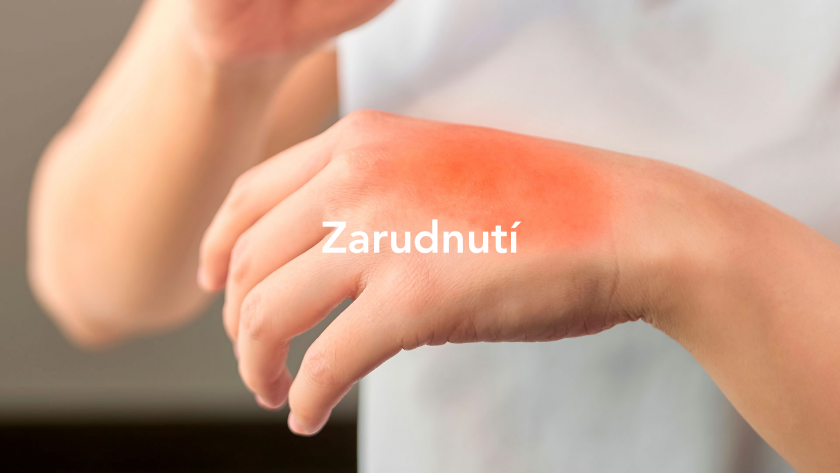 zarudnutí