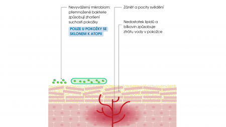 diagram znázorňující faktory způsobující atopii
