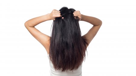 itchy hair