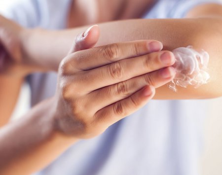 Eczema cream for adults