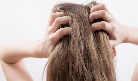 itchy scalp